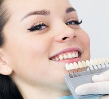 The Use Of Dental Veneers For Teeth Restoration